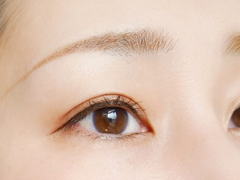 目元の悩みが解消｜30代女性